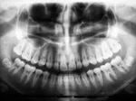 The Importance of Regular Dental Check-Ups Illustration