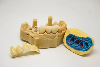 What to Look for When Finding a Denture Clinic Near Me?Illustration